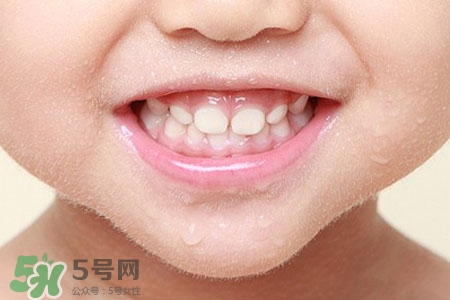 刷牙后吃東西發(fā)苦正常嗎？為什么刷牙后吃東西發(fā)苦？