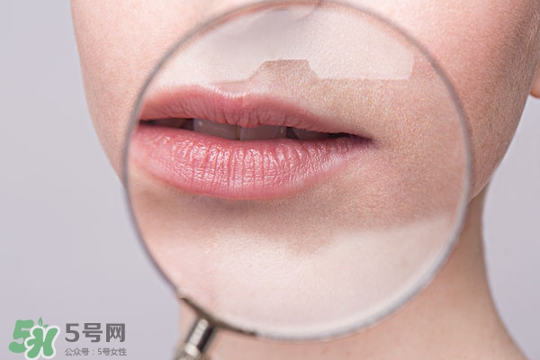 嘴唇起泡腫了怎么辦？嘴唇起泡腫了怎么消腫