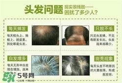 牛角梳梳頭可以生發(fā)嗎？牛角梳怎么梳頭？