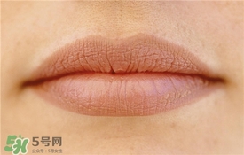 卡唇紋是什么意思？卡唇紋怎么辦？