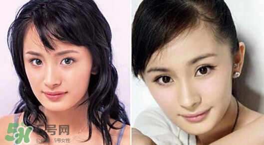 打瘦臉針能懷孕嗎？打瘦臉針能吃避孕藥嗎？