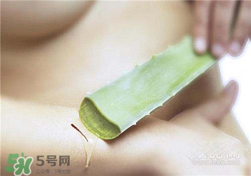 蘆薈涂在臉上發(fā)癢是怎么回事？蘆薈涂在臉上發(fā)癢怎么辦？