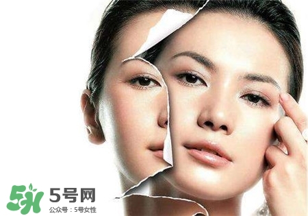 美白針是什么？美白針可以連續(xù)打嗎？