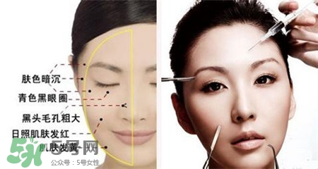 美白針的效果明顯嗎？美白針一個(gè)療程幾次？