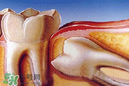 智齒會(huì)引起耳鳴嗎？耳鳴跟智齒有關(guān)系嗎？