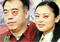臥蠶是黑眼圈嗎？臥蠶和黑眼圈的區(qū)別