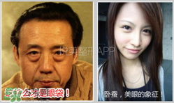 臥蠶是黑眼圈嗎？臥蠶和黑眼圈的區(qū)別