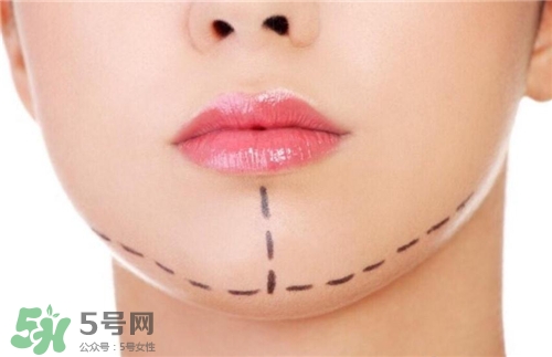 玻尿酸墊下巴能維持多久？玻尿酸墊下巴能維持多長(zhǎng)時(shí)間？