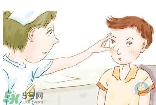紅眼病用什么眼藥水好？紅眼病吃什么好得快