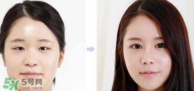 哪些人需要開眼角？需要開眼角的眼睛圖片