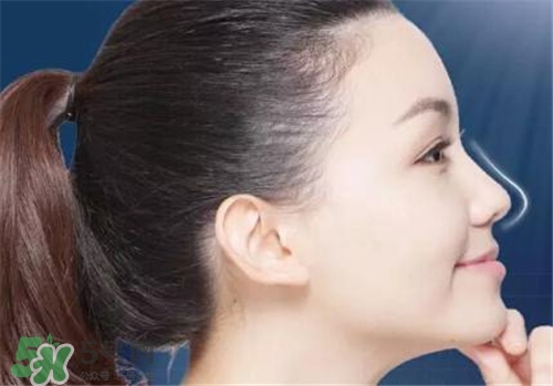 隆鼻會拉近眼距嗎？隆鼻會改變眼睛嗎？