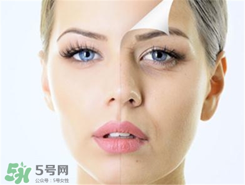 玻尿酸除皺有效果嗎？玻尿酸除皺效果怎么樣？