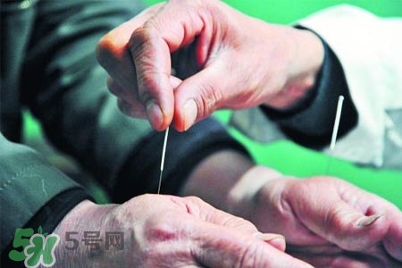 沒(méi)病可以針灸嗎？沒(méi)病可以扎針嗎？