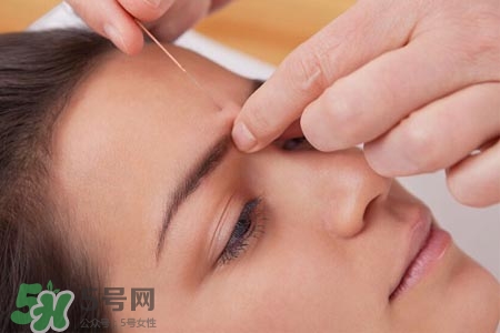 沒(méi)病可以針灸嗎？沒(méi)病可以扎針嗎？