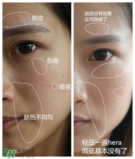 赫拉氣墊用了悶痘嗎？赫拉氣墊悶痘怎么辦？
