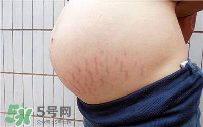 妊娠紋幾個月開始出現(xiàn)？妊娠紋能消除掉嗎？
