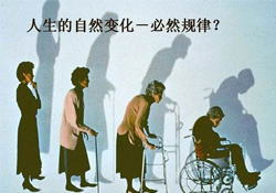 哪些人容易得骨質疏松癥？骨質疏松的高發(fā)人群有哪些？