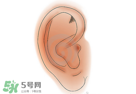 中耳炎有什么癥狀？中耳炎的癥狀表現(xiàn)