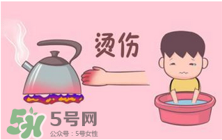 燙傷可以用牙膏嗎？燙傷用牙膏管用嗎？