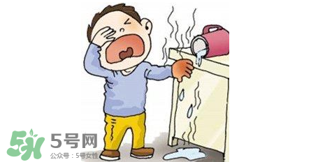 燙傷可以用牙膏嗎？燙傷用牙膏管用嗎？