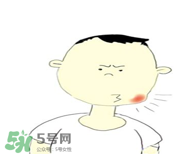 嘴角起泡是什么原因？嘴角起泡怎么辦？
