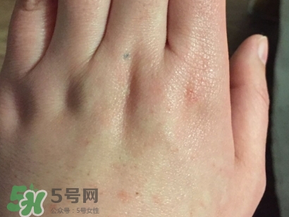 薇諾娜適合什么皮膚？薇諾娜適合敏感肌嗎？