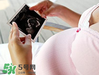 保胎期間可以洗澡嗎？臥床保胎可以洗澡嗎？