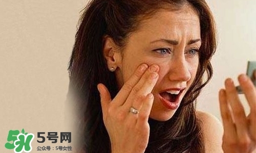 臉色發(fā)黑是什么原因？臉色發(fā)黑發(fā)暗怎么調(diào)理