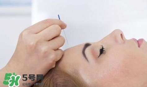 叢集性頭痛會死人嗎？叢集性頭痛的特點