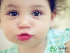 孕期可以激光祛斑嗎？懷孕了能做激光祛斑嗎？