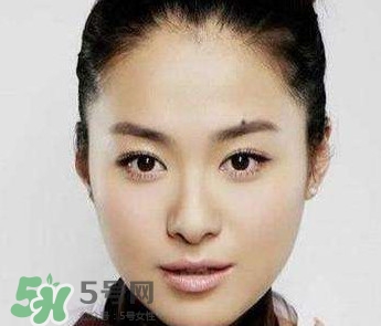 如何預(yù)防臉上長痣？怎樣預(yù)防臉上長痣