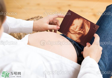 橄欖油真的可以預(yù)防妊娠紋嗎？橄欖油真的可以去妊娠紋嗎？