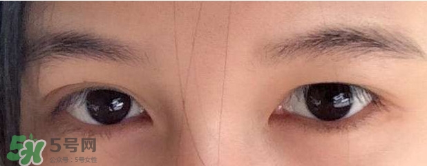 眼睛發(fā)黃是怎么回事？眼睛發(fā)黃是什么原因
