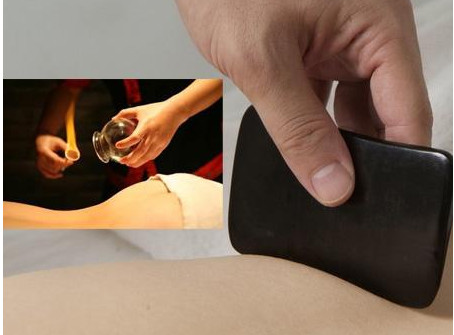 刮痧之后可以拔罐嗎？刮痧之后可不可以拔罐