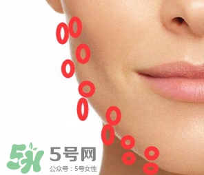 nuface美容儀有效嗎？nuface美容儀副作用？