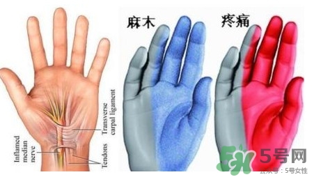 手腳發(fā)麻是缺鈣嗎？手腳發(fā)麻是不是缺鈣