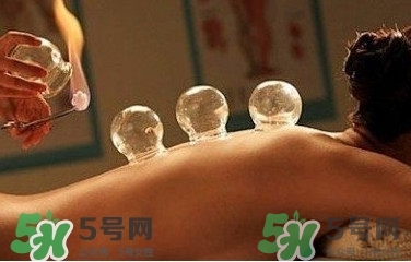 拔火罐疼嗎？拔火罐疼不疼