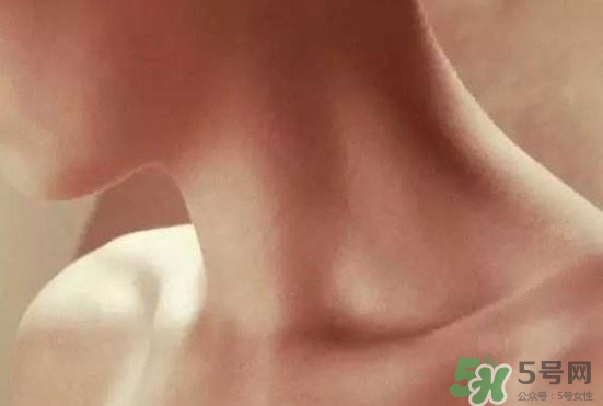 頸椎老化是什么病？頸椎老化的癥狀
