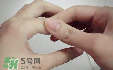 痛風(fēng)有什么癥狀？女性痛風(fēng)的初期癥狀