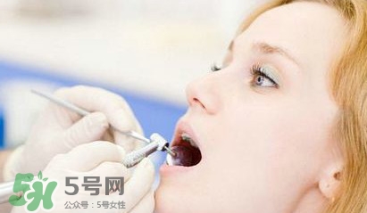 牙齒松動能自己恢復嗎？牙齒松動會自己恢復嗎