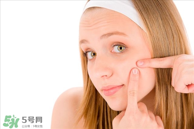 得了痤瘡飲食注意什么？有痤瘡吃東西注意什么
