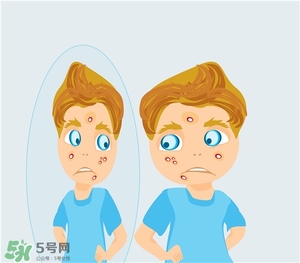 得了痤瘡飲食注意什么？有痤瘡吃東西注意什么