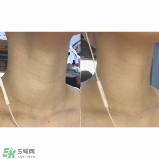 悅薇適合什么年齡？資生堂悅薇適合年齡段