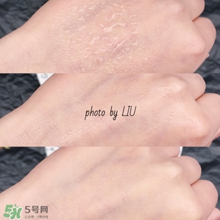 美帕b5噴霧有激素嗎？美帕噴霧副作用