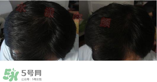  資生堂不老林洗發(fā)水怎么樣？資生堂不老林洗發(fā)水能長頭發(fā)嗎