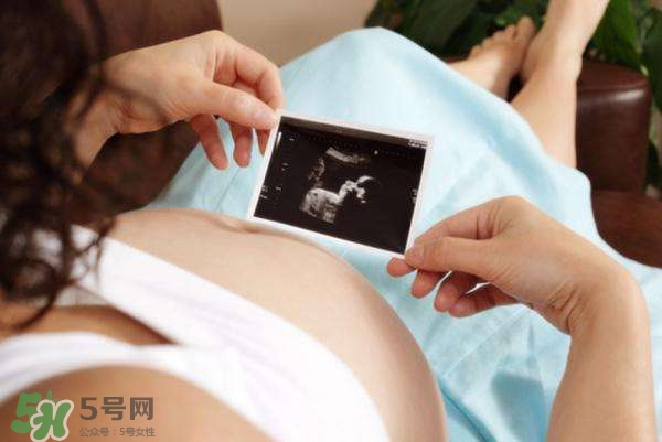 四維彩超能看出男女嗎？四維彩超能看清手指嗎？