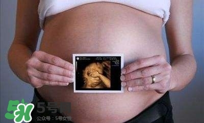 四維彩超能看出男女嗎？四維彩超能看清手指嗎？