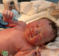 新生兒手握避孕環(huán)出生是怎么回事？出生后健康嗎？