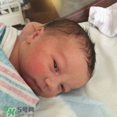 新生兒手握避孕環(huán)出生是怎么回事？出生后健康嗎？