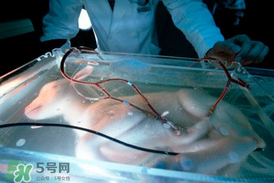 人造子宮能生孩子嗎？人造子宮成功案例